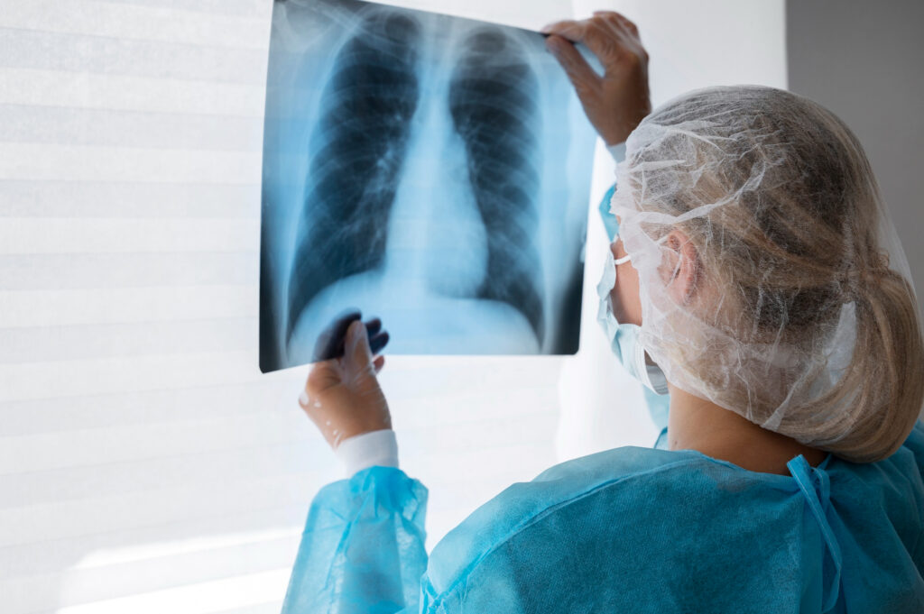 Cáncer de Pulmón