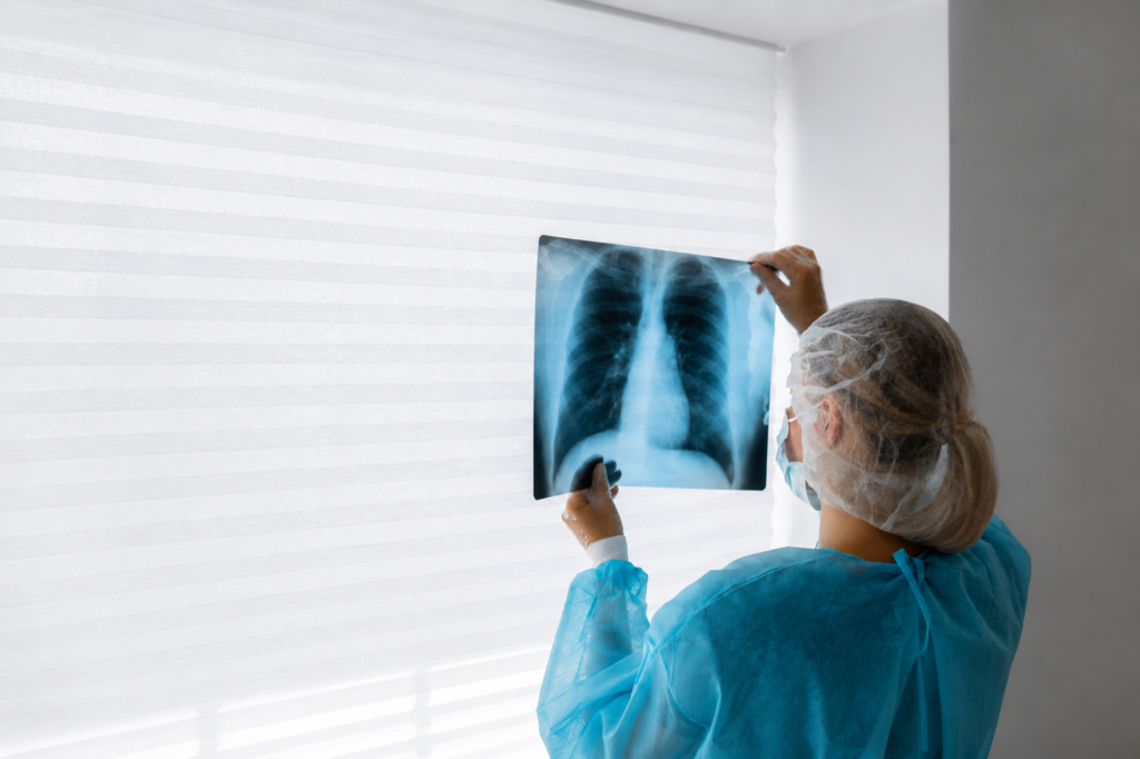 Cáncer de Pulmón