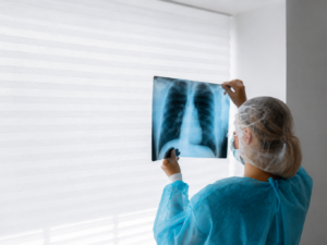 Cáncer de Pulmón